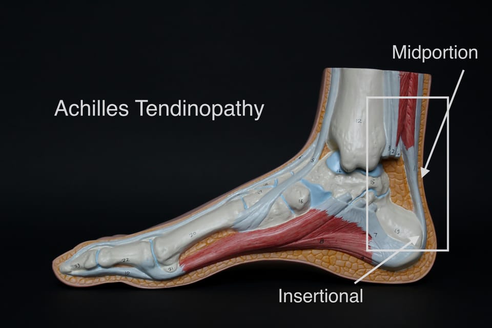 How To Treat Achilles Tendinopathies